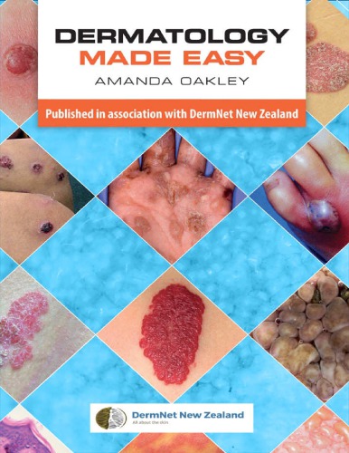 Dermatology Made Easy