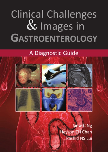 Clinical Challenges &amp; Images in Gastroenterology