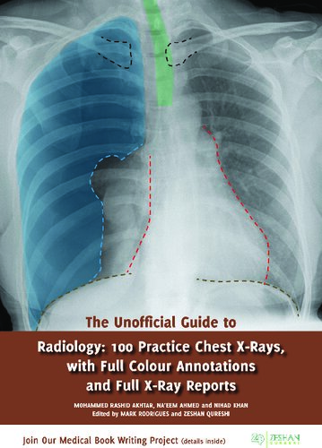 The Unofficial Guide to Radiology