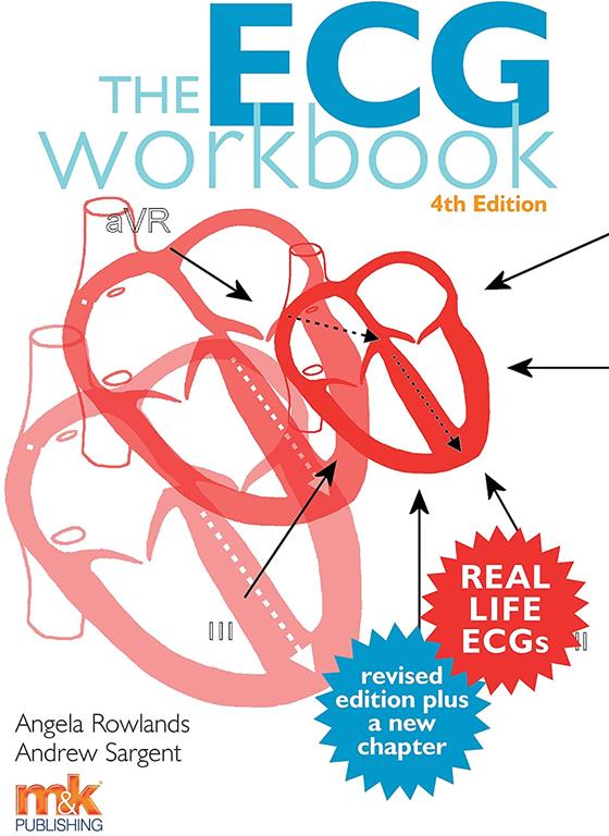 The ECG Workbook 4/ed