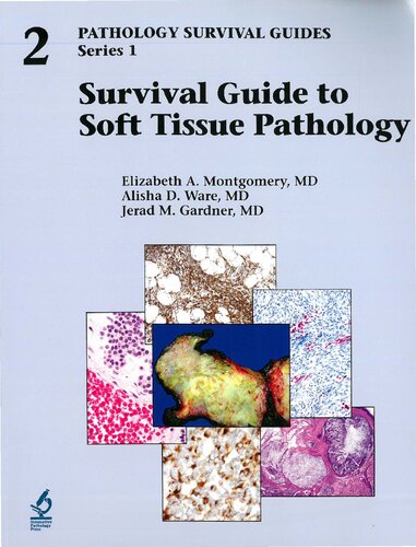 Survival guide to soft tissue pathology