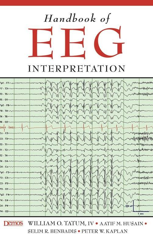 Handbook of EEG Interpretation