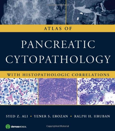 Atlas of Pancreatic Cytopathology