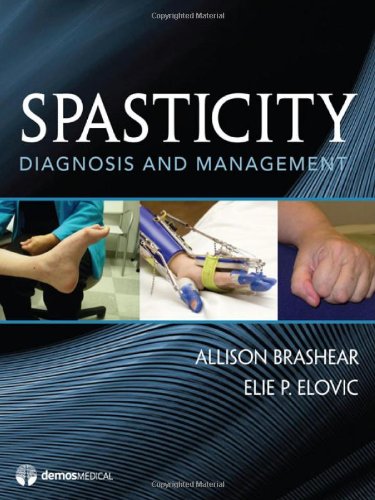 Spasticity