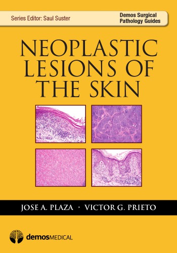 Neoplastic Lesions of the Skin