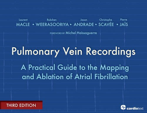 Pulmonary Vein Recordings