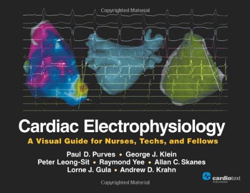 Cardiac Electrophysiology