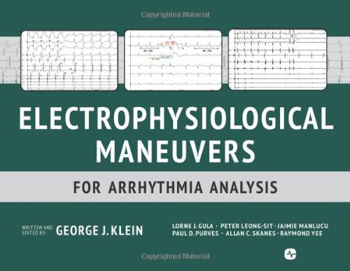 Electrophysiological Maneuvers for Arrhythmia Analysis