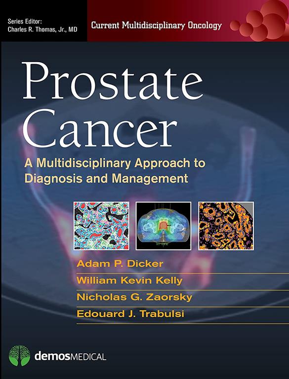 Prostate Cancer: A Multidisciplinary Approach to Diagnosis and Management (Current Multidisciplinary Oncology)