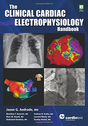 The Clinical Cardiac Electrophysiology Handbook