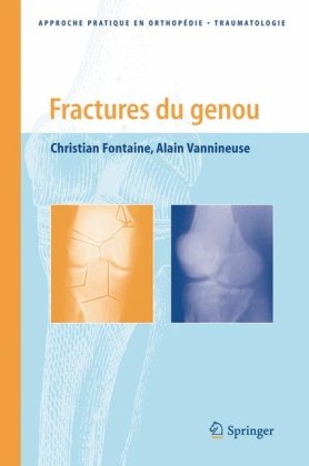 Fractures du genou.