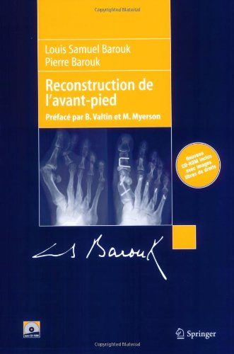 Reconstruction de L'Avantpied