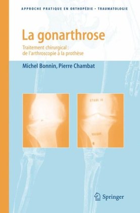 La Gonarthrose