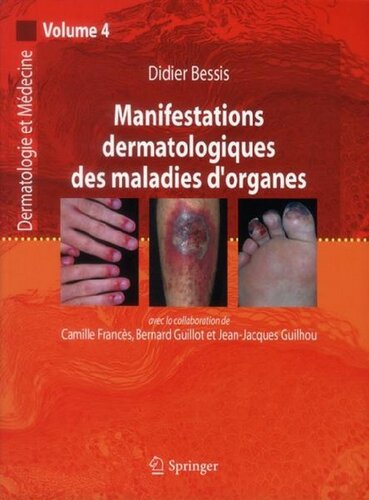 Manifestations Dermatologiques Des Maladies d'Organes