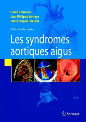 Les Syndromes Aortiques Aigus