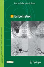 Embolisation