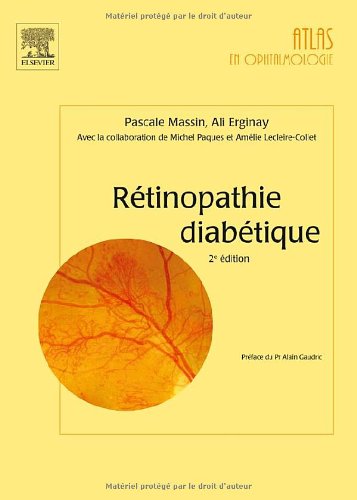 R�tinopathie Diab�tique