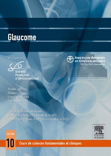 Glaucome