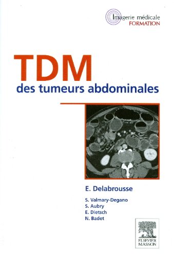 TDM Des Tumeurs Abdominales