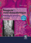 Imagerie Musculosquelettique