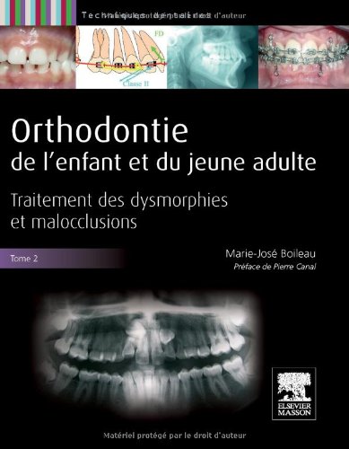 Orthodontie de l'Enfant Et Du Jeune Adulte -Tome 2