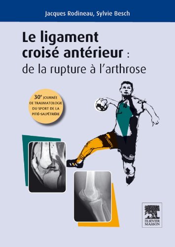 Le ligament croisé antérieur 