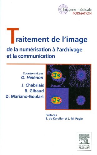 Traitement de L'Image