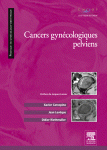 Cancers Gyn�cologiques Pelviens