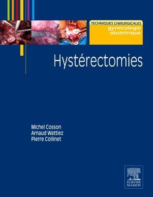 Hysterectomies