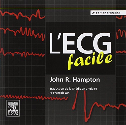 L'ECG facile