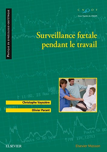 Surveillance Foetale Pendant Le Travail