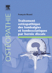 Traitement ostéopathique des lombalgies et lombosciatiques par hernie discale