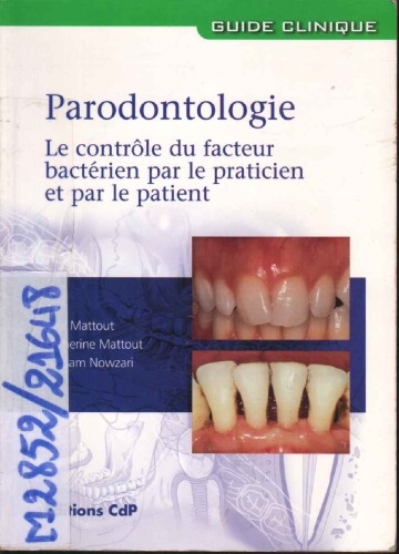 Parodontologie : le contrôle du facteur bactérien par le praticien et par le patient