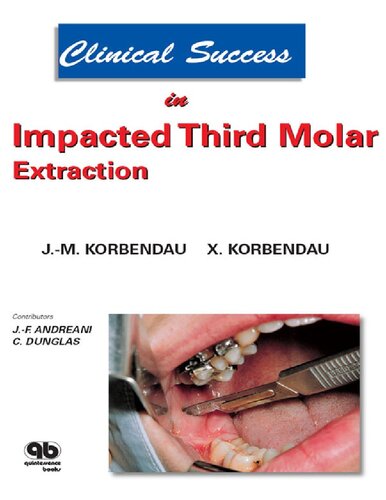 Clinical Success in Impacted Third Molar Extraction.