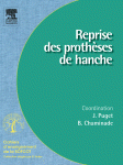 Reprise Des Proth�ses de Hanche