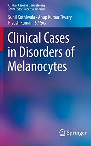 Clinical Cases in Disorders of Melanocytes