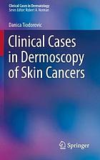 Clinical cases in dermoscopy of skin cancers