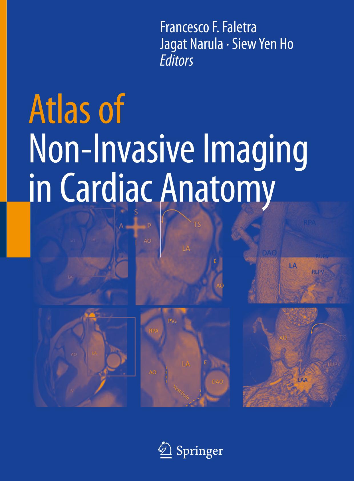 Atlas of non-invasive imaging in cardiac anatomy