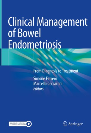 Clinical management of bowel endometriosis : from diagnosis to treatment