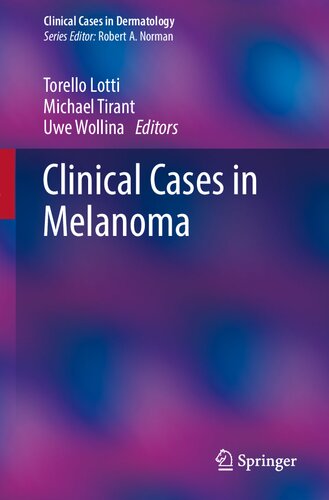 Clinical cases in melanoma