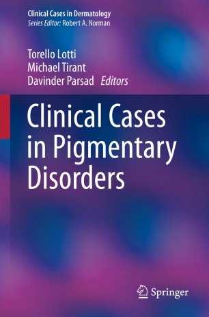 Clinical cases in pigmentary disorders