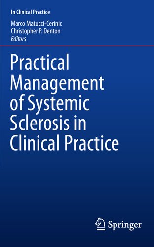 Practical management of systemic sclerosis in clinical practice