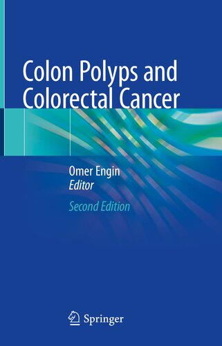 Colon polyps and colorectal cancer