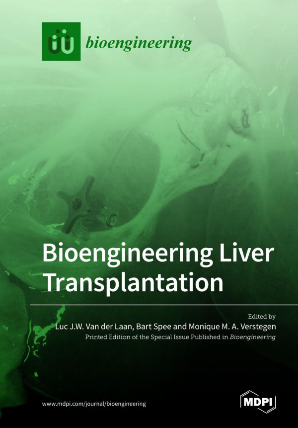 Bioengineering liver transplantation