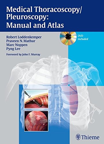 Medical Thoracoscopy / Pleuroscopy