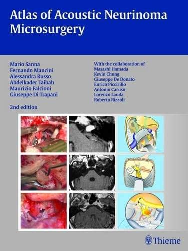 Atlas of Acoustic Neurinoma Microsurgery: . Zus.-Arb.: Mario Sanna Essam Saleh, Benedict Panizza, Alexandra Russo, Abdel TaibahWith the collaboration of Refik Caylan, Fernando Mancini ...