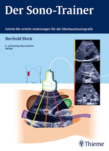 Der Sono-Trainer Schritt-für-Schritt-Anleitungen für die Oberbauchsonografie