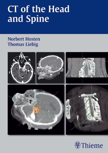 CT of the Head and Spine