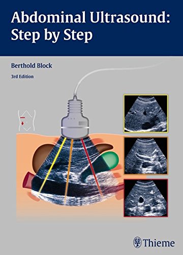 Abdominal Ultrasound