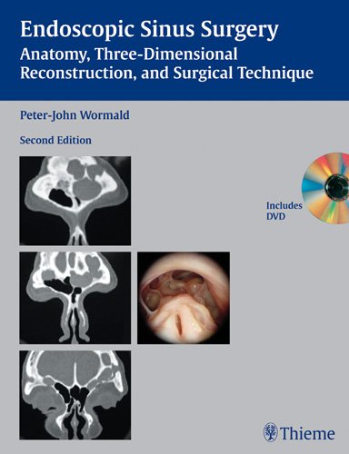 Endoscopic Sinus Surgery